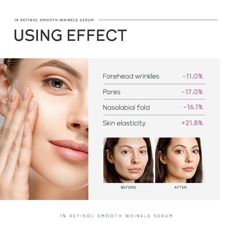 เซรั่มลดเลือนริ้วรอย Quiyum 1% - The Ordinary Serum Hyaluronic Acid บทวิจารณ์และราคา
